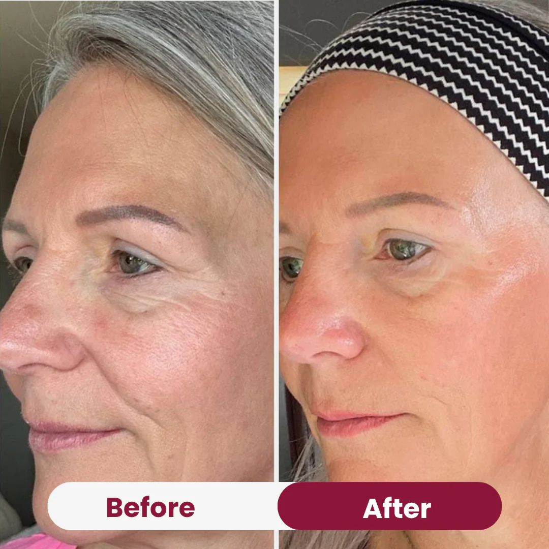 Bio Collagen Mask