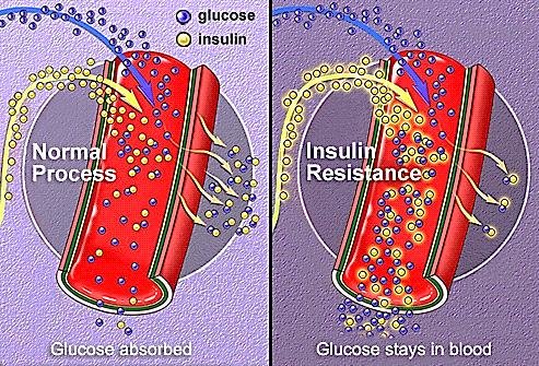 Normal glucose absorption vs insulin resistance